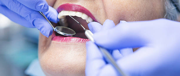 Teeth Whitening in OH